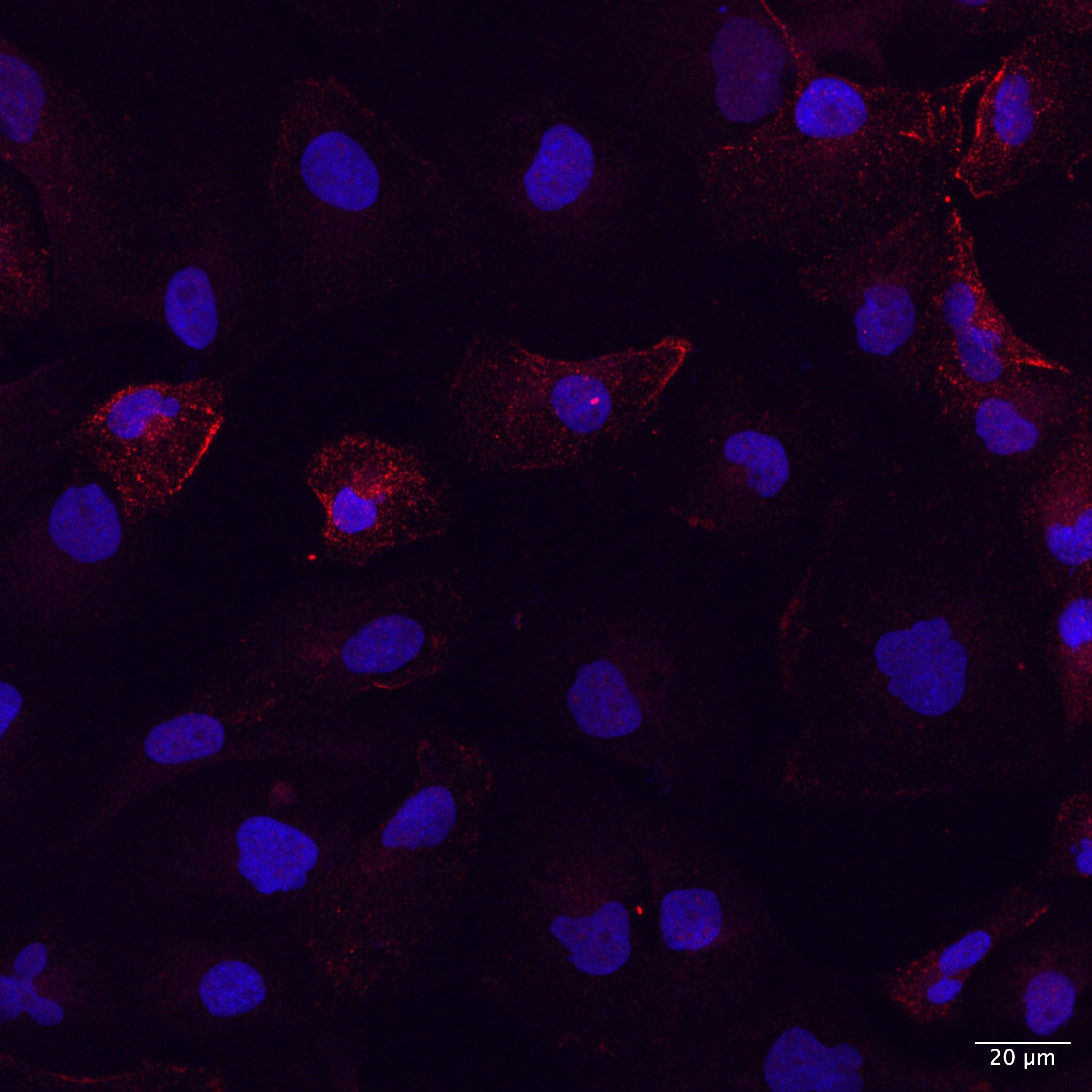 Human/Mouse/Rat Cubilin Antibody AF3700